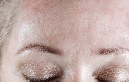 Front d'une femme qui pèle