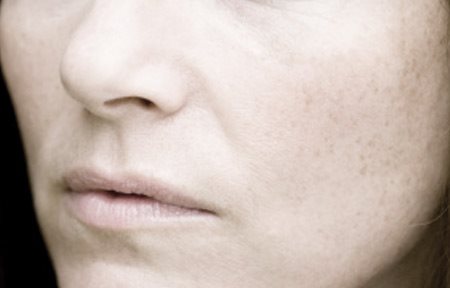 Visage de femme présentant des ridules et des rougeurs